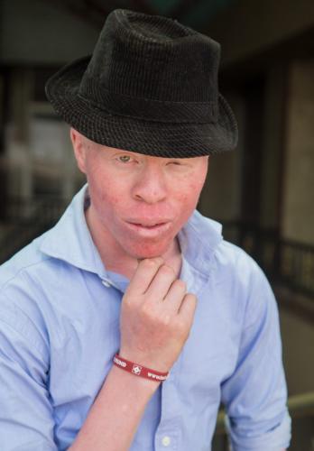 PERSONS WITH ALBINISM 12
