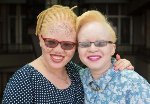 PERSONS WITH ALBINISM 13
