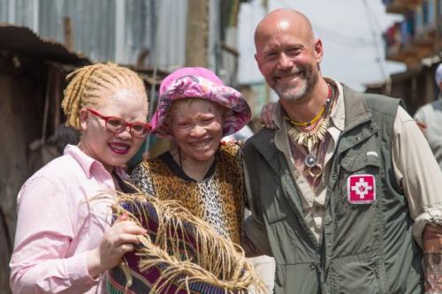 PERSONS WITH ALBINISM 18