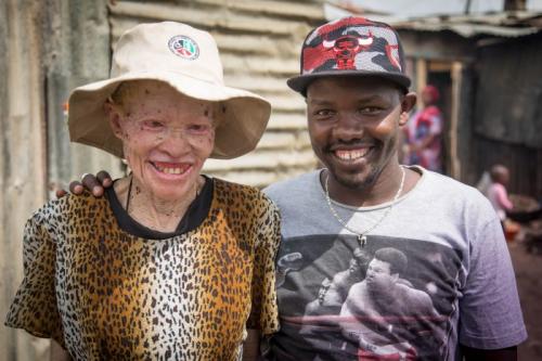 PERSONS WITH ALBINISM 22