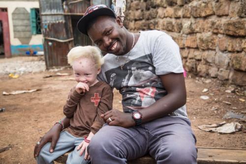 PERSONS WITH ALBINISM 24