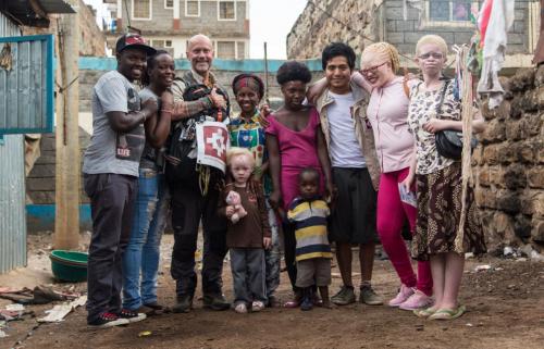PERSONS WITH ALBINISM 26