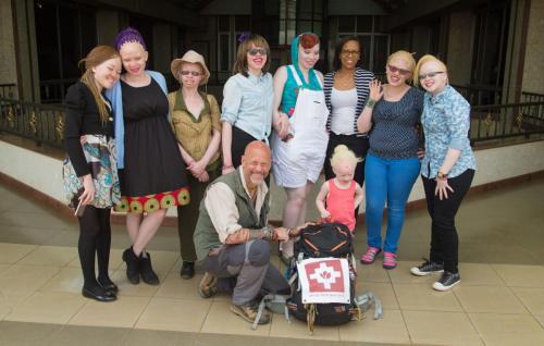 PERSONS WITH ALBINISM 32