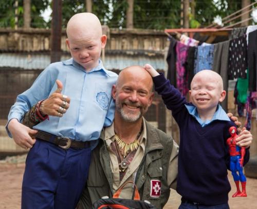 PERSONS WITH ALBINISM 42