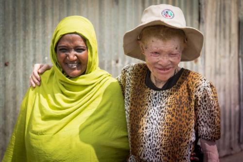 PERSONS WITH ALBINISM 5