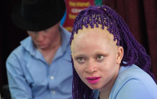 PERSONS WITH ALBINISM 6
