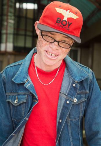 PERSONS WITH ALBINISM 7