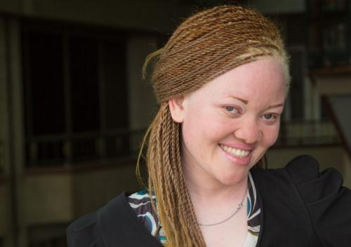 PERSONS WITH ALBINISM 8