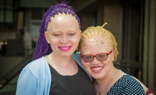 PERSONS WITH ALBINISM 9